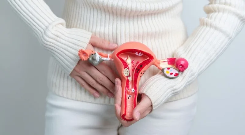 ANS inclui DIU hormonal no rol de cobertura para pacientes com endometriose